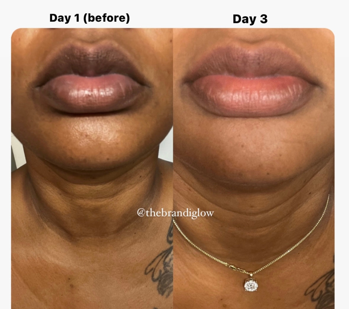 Luscious Lips (lip mask)