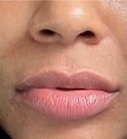 Luscious Lips (lip mask)