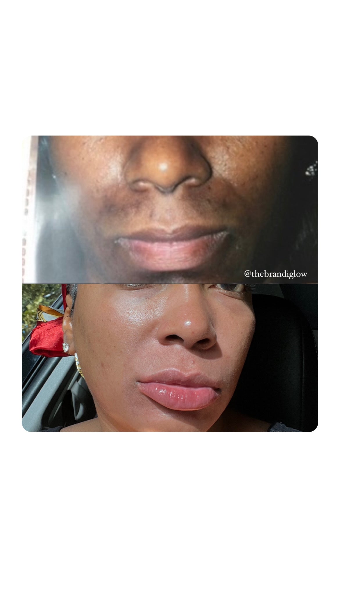 Luscious Lips (lip mask)