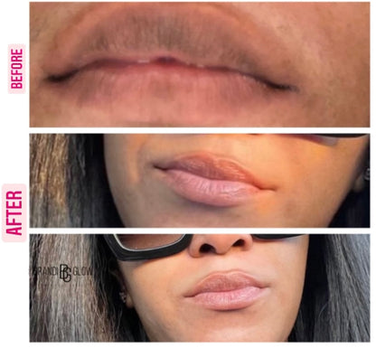 Luscious Lips (lip mask)