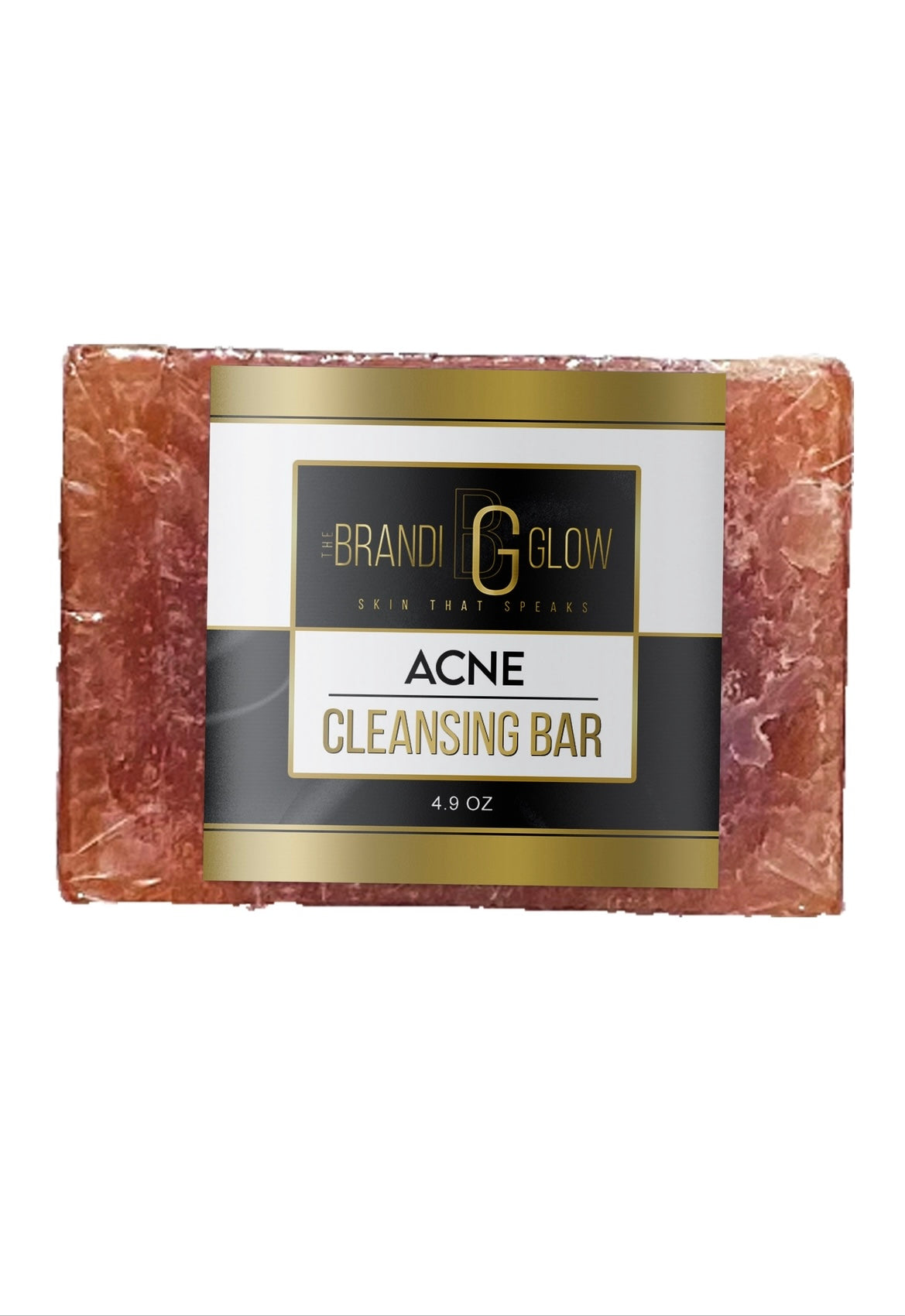 Acne Cleansing Bar